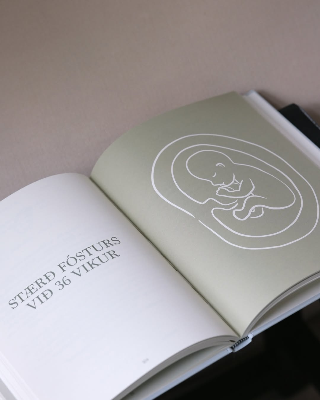 Meðgöngudagbók - FRÁ BUMBU TIL FÆÐINGAR