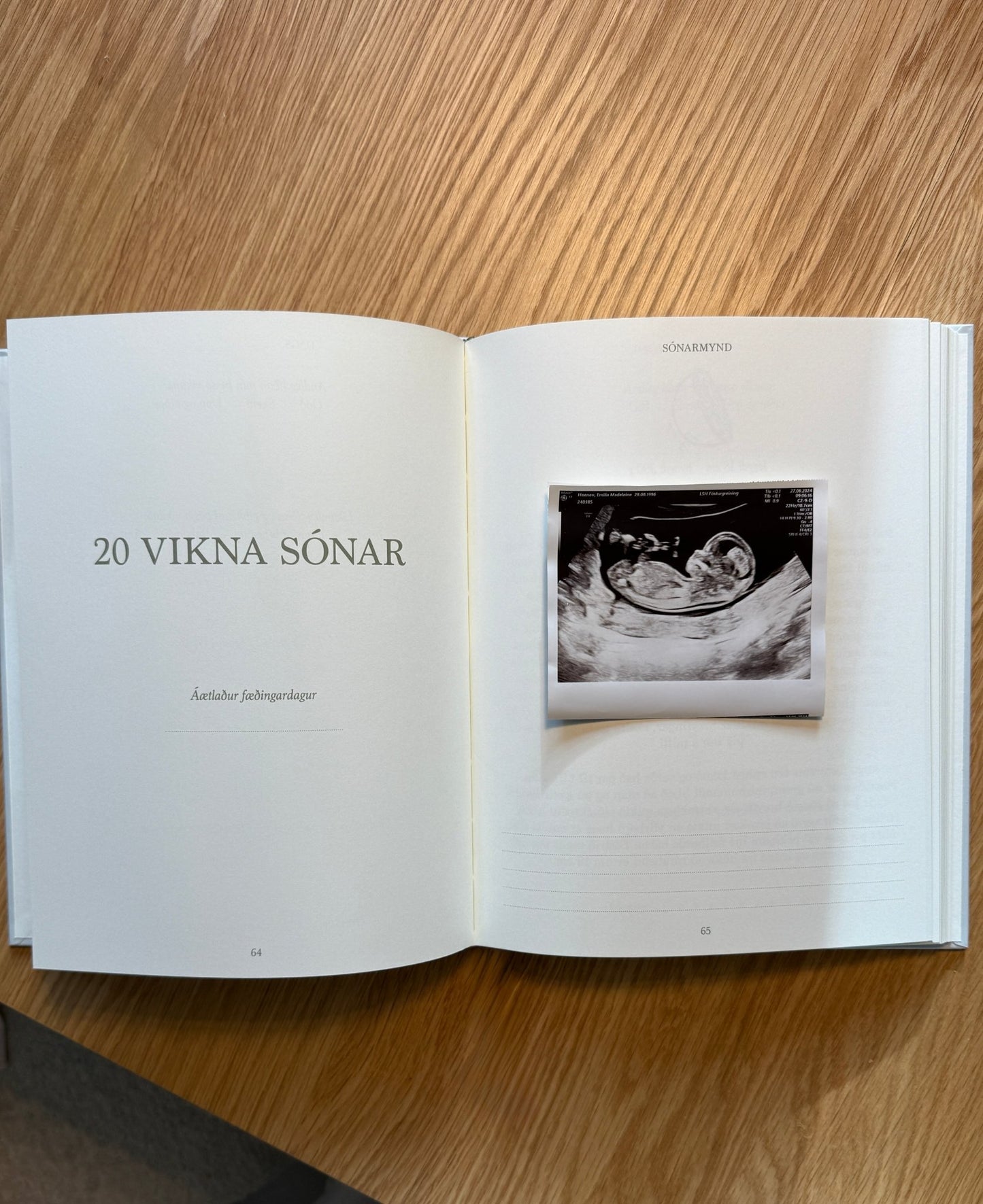 Meðgöngudagbók - FRÁ BUMBU TIL FÆÐINGAR